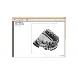 Program CAD/CAM exocad Standard exocad