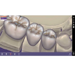 Program CAD/CAM exocad Standard exocad
