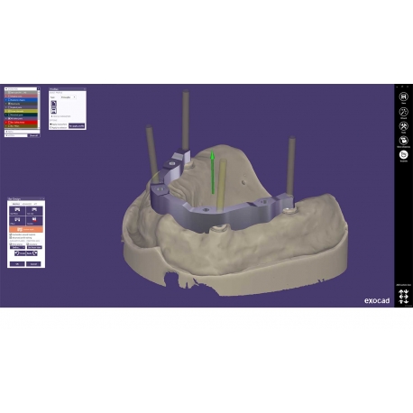 Modul exocad Bar exocad