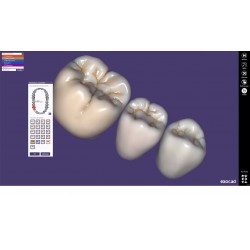 MODUL EXOCAD TRUSMIL