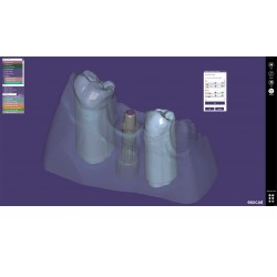 MODUL EXOCAD Model C