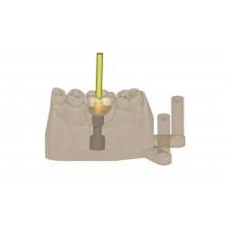 MODUL EXOCAD Model C