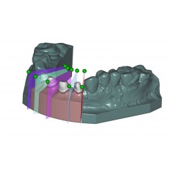 MODUL EXOCAD Model C