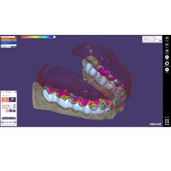 MODUL EXOCAD Bite Sp