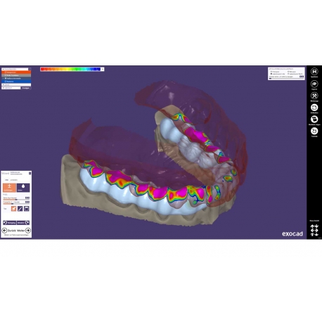 MODUL EXOCAD Bite Sp