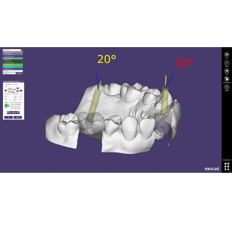 MODUL EXOCAD IMPLANT