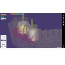 MODUL EXOCAD IMPLANT