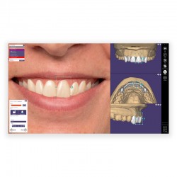 MODUL EXOCAD Smile Creator