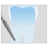 Freze Diamant PerioRed 831 - 3 buc. 