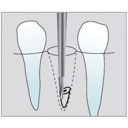 Freze Surgical cutters FGXXL  C560  317 008