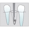Freze Surgical cutters FGXXL  C560  317 008