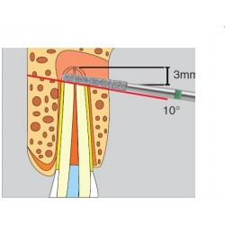 Freze Surgery Diamond FGXXL  D254  317 016