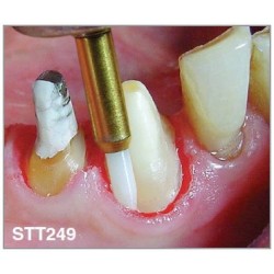 Freze Soft Tissue Trimmer  STT2 49 314 016