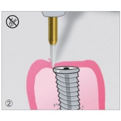Freze Soft Tissue Trimmer  STT2 49 314 016