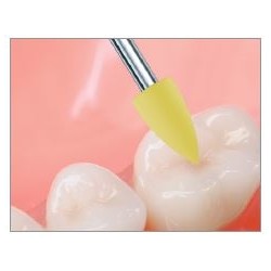 Freze Ceramic Finishing Kit  3005 5SO