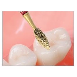 Freze Ceramic Finishing Kit  3005 5SO