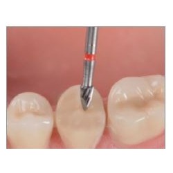 Freze Composite Finishing Kit  1905 0SO