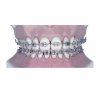 Arc Ni-ti rotund inf.0.12 -10buc