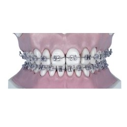 Arc Ni-ti rectangular inf.0.16x0.22-10buc