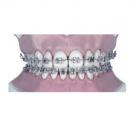 Arc Ni-ti rectangular inf.0.16x0.22-10buc