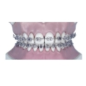Arc Ni-ti rectangular inf.0.16x0.22-10buc