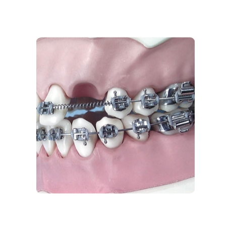 Arc deschis Coil Spring Heavy 2 buc.