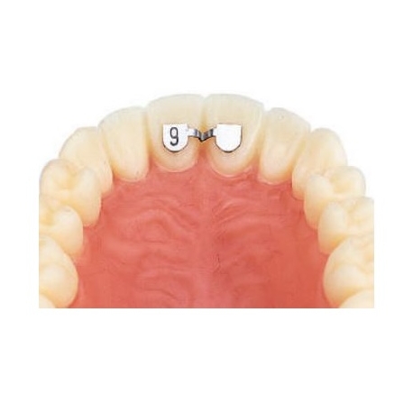 Retainer Superior incisivi centrali 6mm Leone