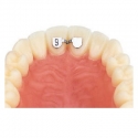 Retainer Superior incisivi centrali 6mm Leone
