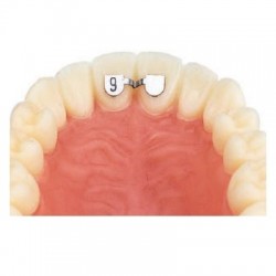 KIT D.B. RETAINERS - SUPERIOR - 20buc