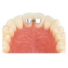 KIT D.B. RETAINERS - SUPERIOR - 20buc