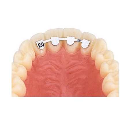 D.B. RETAINERS - UPPER LAT/LAT 14mm - 10buc