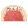 D.B. RETAINERS - UPPER LAT/LAT 14mm - 10buc