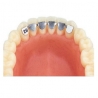 Retainer inferior de la canin la canin 31mm 2buc