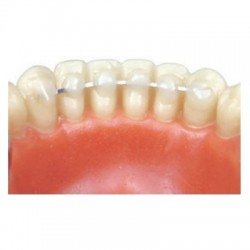 Flat woven wire for retainer