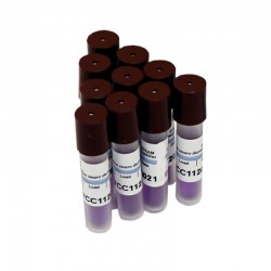 Indicator biologic...