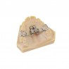 Surub disjunctie CAD/CAM Anatomical Expander 10mm Leone