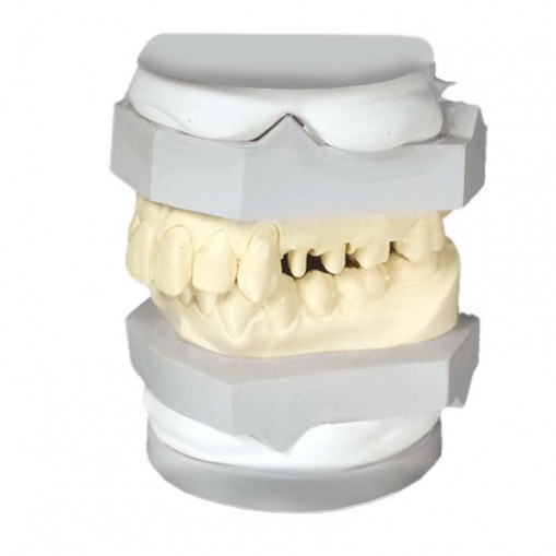 Gips articulator SheraArti-Quick white 20kg Shera