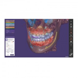 exoplan Core cu modul Guide Creator 1 licenta