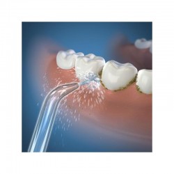 Rezerva 2 Capete Waterpik Classic High-Pressure Jet Tip JT-450E