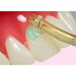 Matrici cervicale transparente 150 bucati Kerr