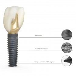 Implant DS PrimeTaper EV D3.6 Dentsply Sirona