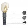 Implant DS PrimeTaper EV D4.2 Dentsply Sirona