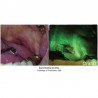 Scanner Depistare Cancer Bucal OralID Kit Forward-Science