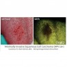 Scanner Depistare Cancer Bucal OralID Kit Forward-Science