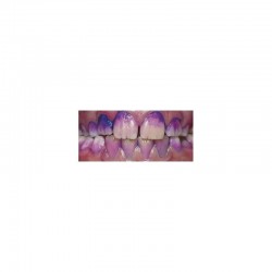 Tablete indicatoare de placa bacteriana Curaprox