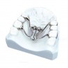 Surub disjunctie Mini Rapid Expander in evantai 7mm 1 bucata Leone