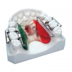 Tuburi palatinale MIM 1.1mm dispozitivul de distalizare First Class Leone