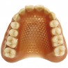 Plasa proteze aurie Fino