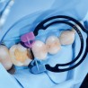 myTines Small Refill 6 perechi Polydentia
