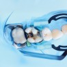 myTines Large Refill 6 perechi Polydentia